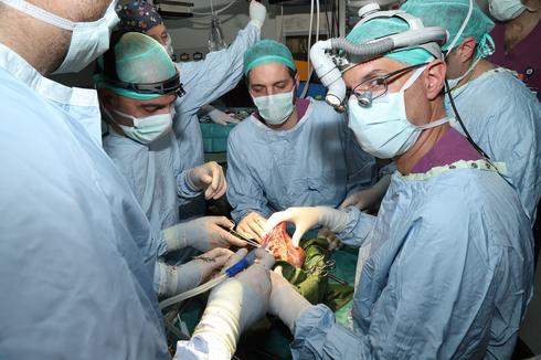 Cirugía de hígado en el Hospital Sheba