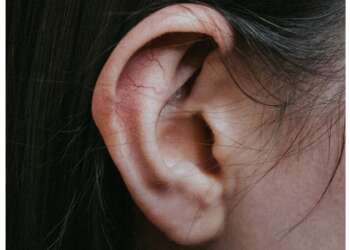 sordera Universidad de Tel Aviv