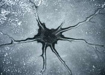 esperanza para los pacientes con ELA