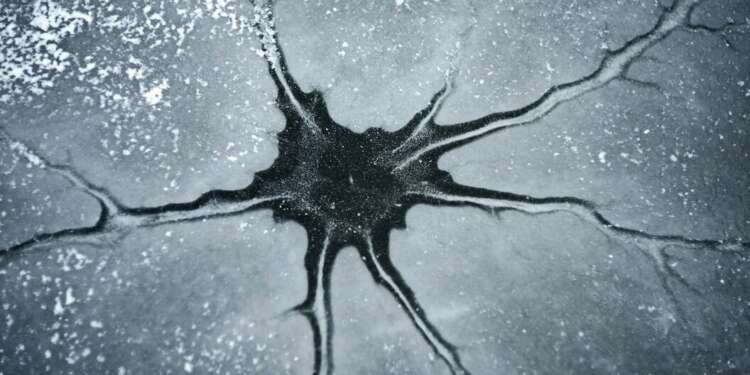 esperanza para los pacientes con ELA